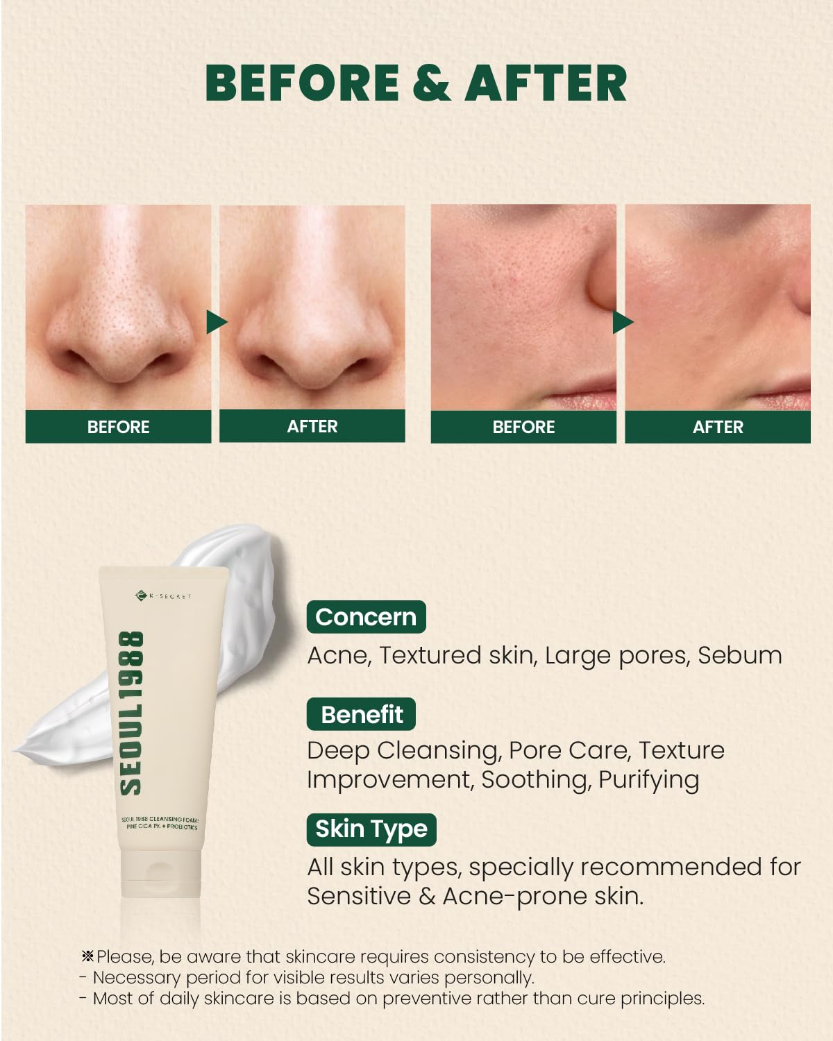 KSECRET SEOUL 1988 Cleansing Foam: Pine Cica 1% + Probiotics (150ml)